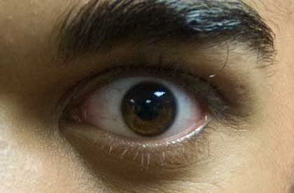 Eye