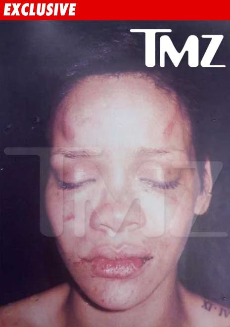 Rihanna Beating