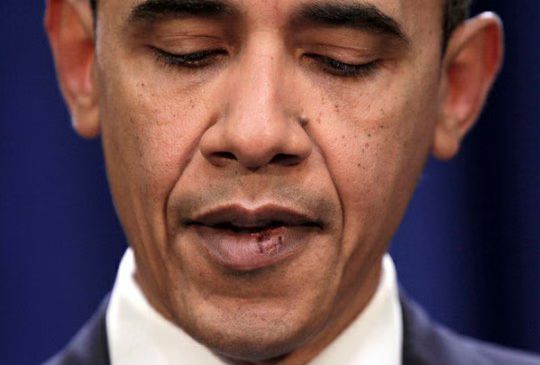 Barack Obama Lip Stitches.jpg