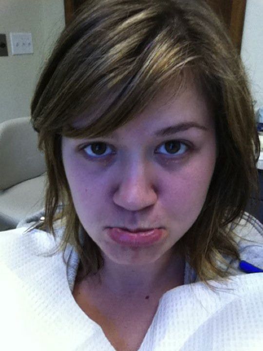 Kelly Clarkson Root Canal.jpg