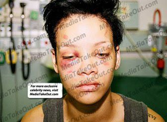 Rihanna Chris Brown Abuse.jpg