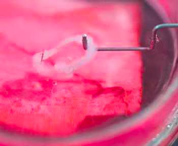 Functioning Anal Sphincter Grown in a Petri Dish