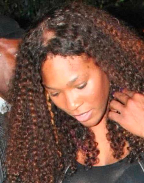 Serena Williams Bald Spot 01-2011-10-19.jpg Serena Williams Bald Spot 01 2011 10 19
