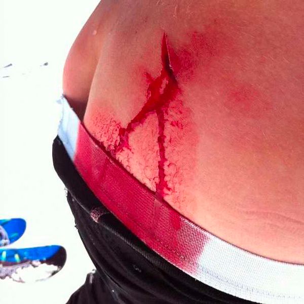 Patrick Schwarzenegger injured in ski accident 02 2012 03 11