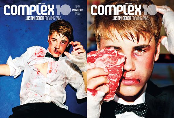 bieber-complex