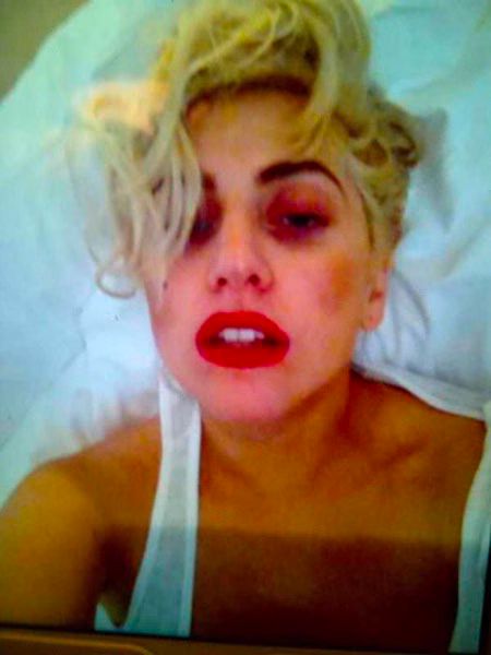 Lady Gaga Black Eye Photo