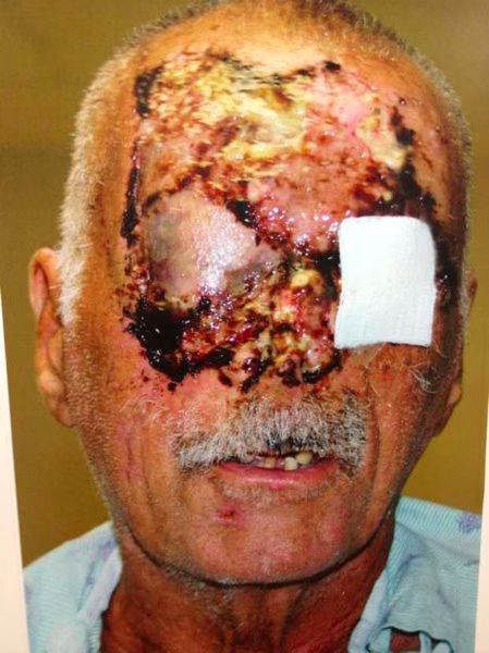 Miami Zombie Attack Victim Photos Released 01 2012 06 12