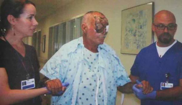 Miami Zombie Attack Victim Photos Released 02 2012 06 12