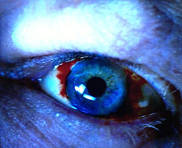 Fringe S5E1: Eye