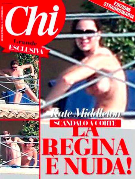 Kate Middleton  Topless Photos in Chi Magazine Italy  Photo