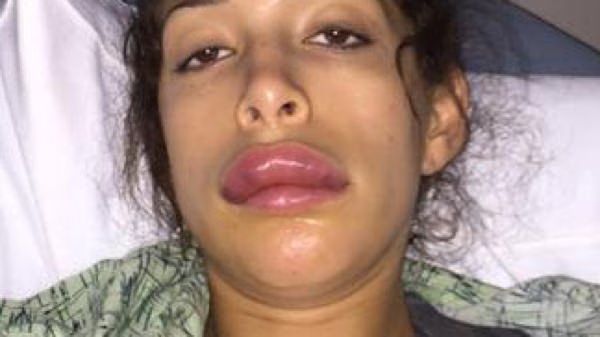 Farrah Abraham has HUGE lips