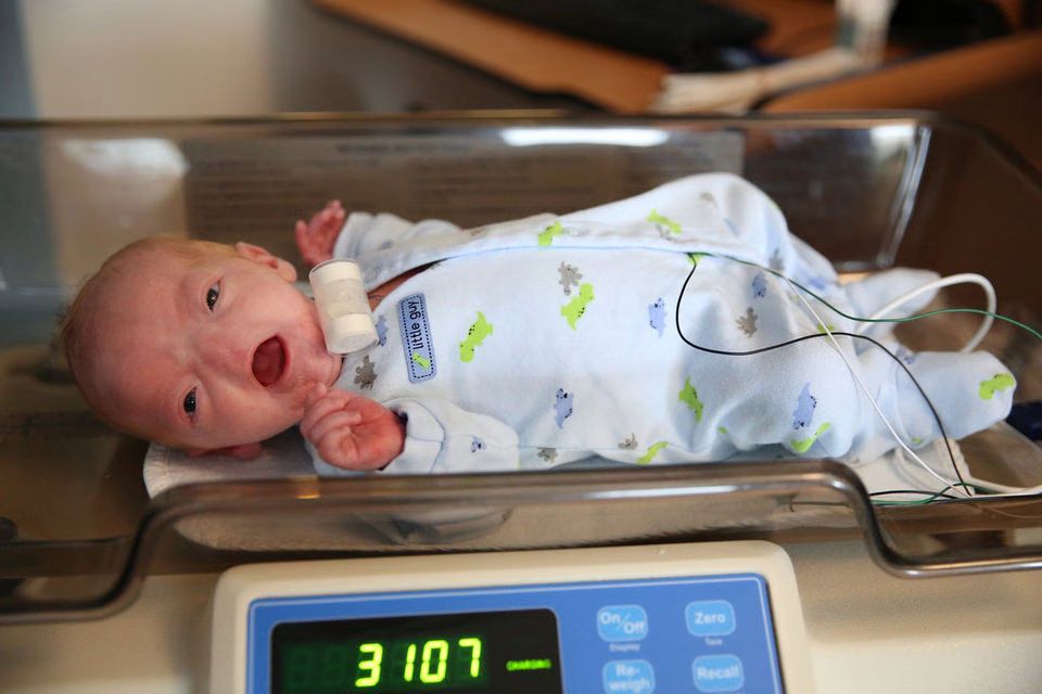 Baby Born Without A Nose Is Finally Home (PHOTO, VIDEO)