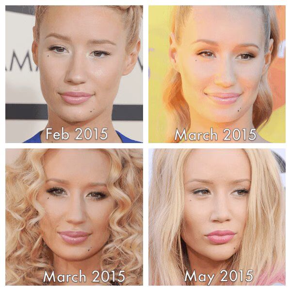 Iggy Azelea New Face