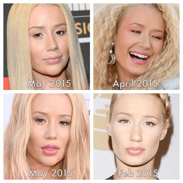 Some People Really Want Iggy Azelea To Have a New Face (PHOTOS)