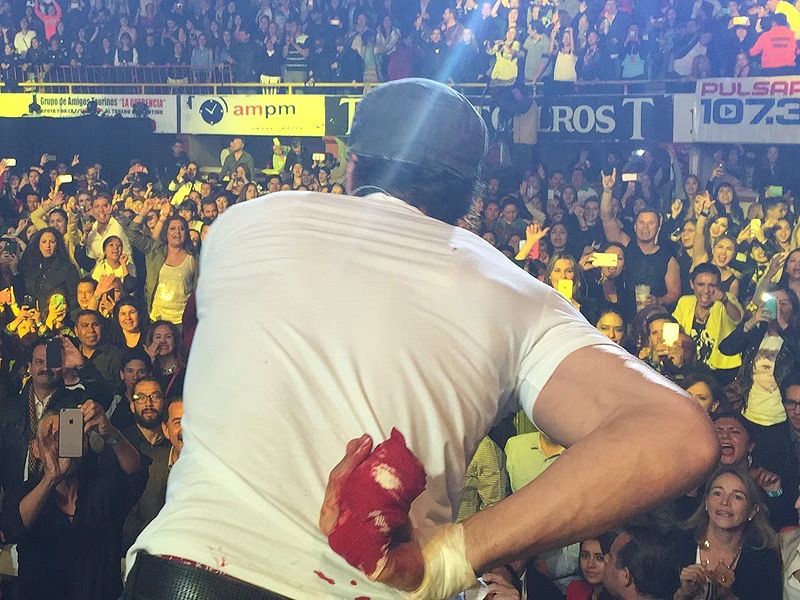 Bloody Enrique Iglesias Slices Fingers During Concert (PHOTOS)