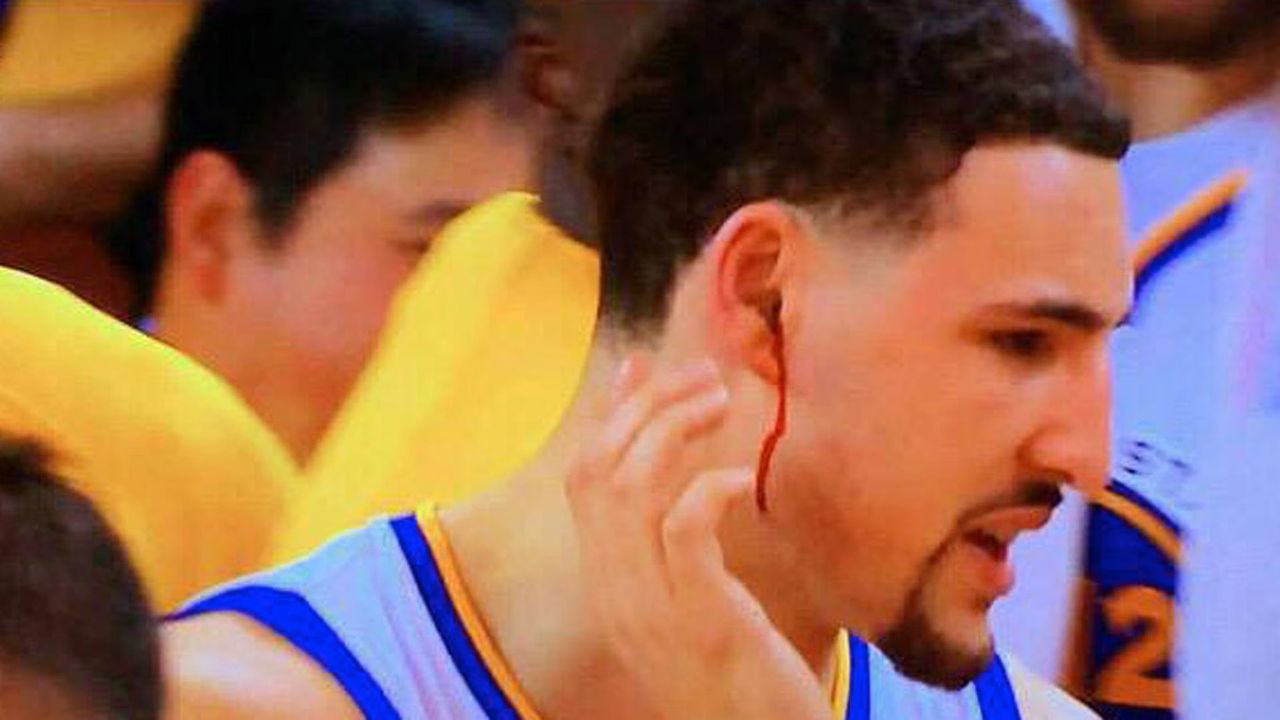 Klay Thompson Cleared To Play In Game 1 Of NBA Finals After Concussion